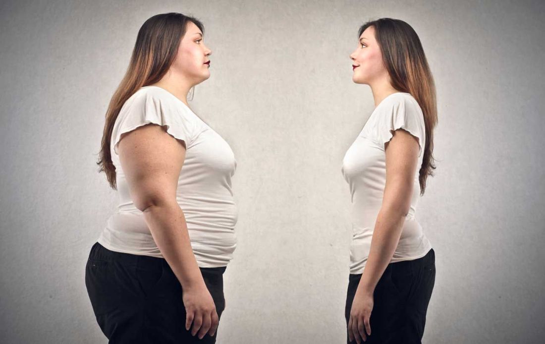 obese-vs-thin-woman-1296x818
